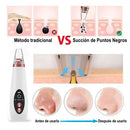 Limpiador Facial Portátil - SoftSkin™