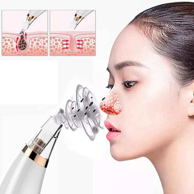 Limpiador Facial Portátil - SoftSkin™